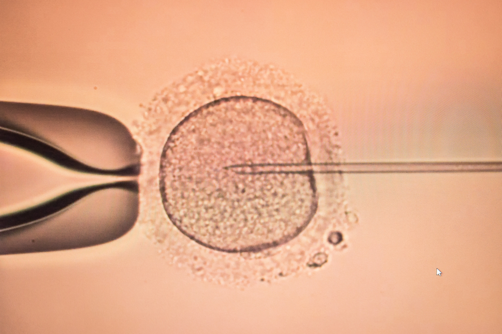 Principales diferencias entre la lnseminación Artificial y la Fecundación In Vitro