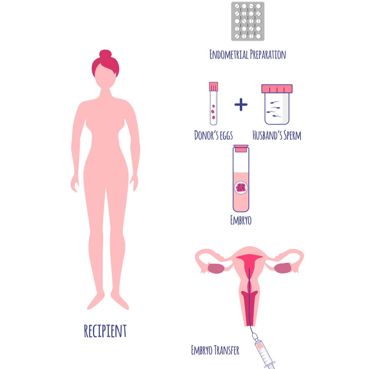 Transferencia embrionaria