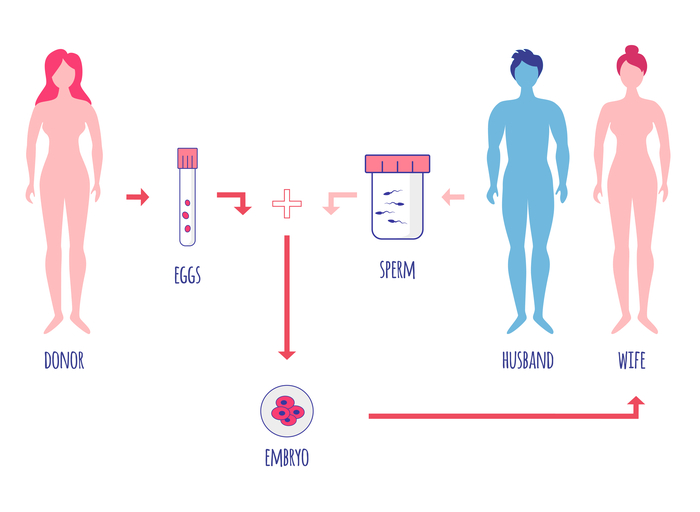 FIV con óvulos de donante y semen de la pareja 