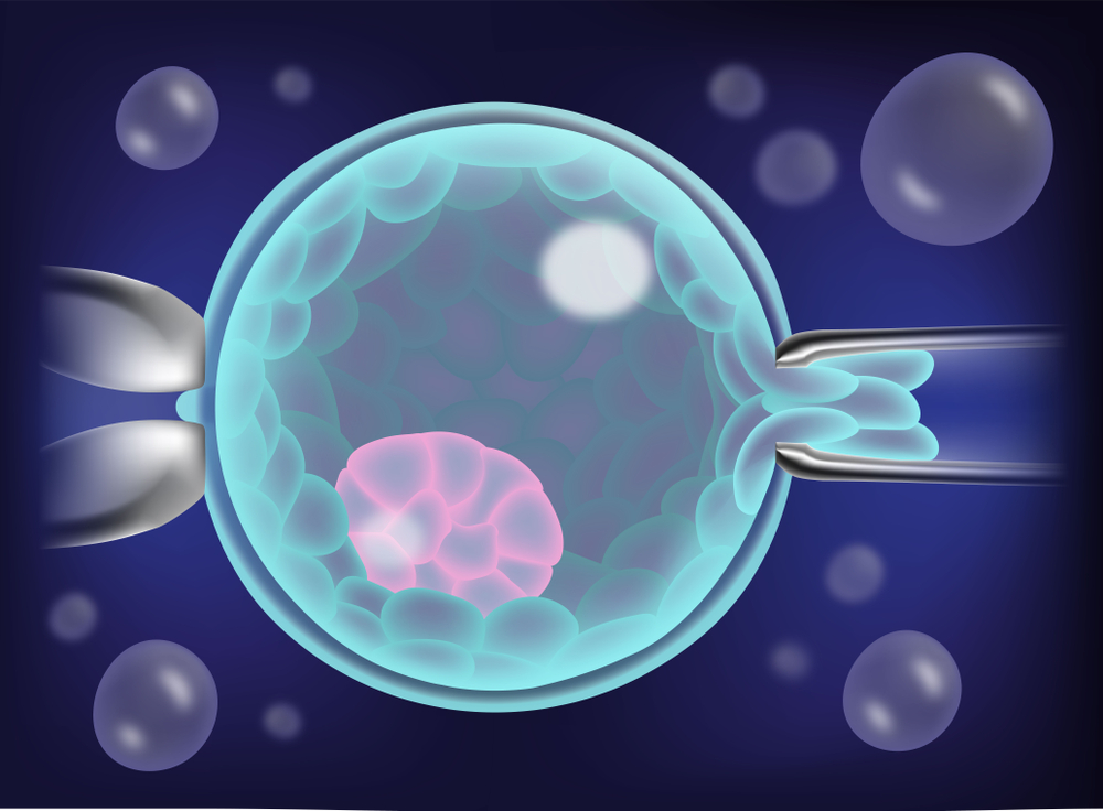 Diagnóstico genético preimplantacional