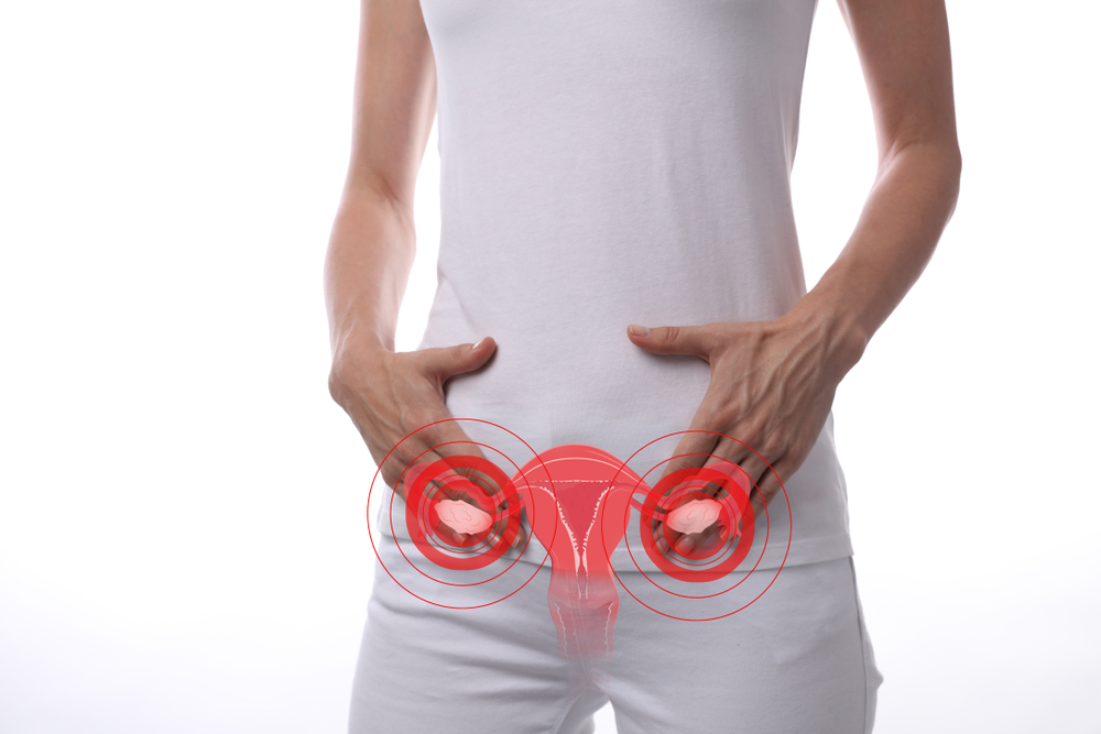 ¿Qué es el Síndrome de Ovario Poliquístico, a quien afecta?