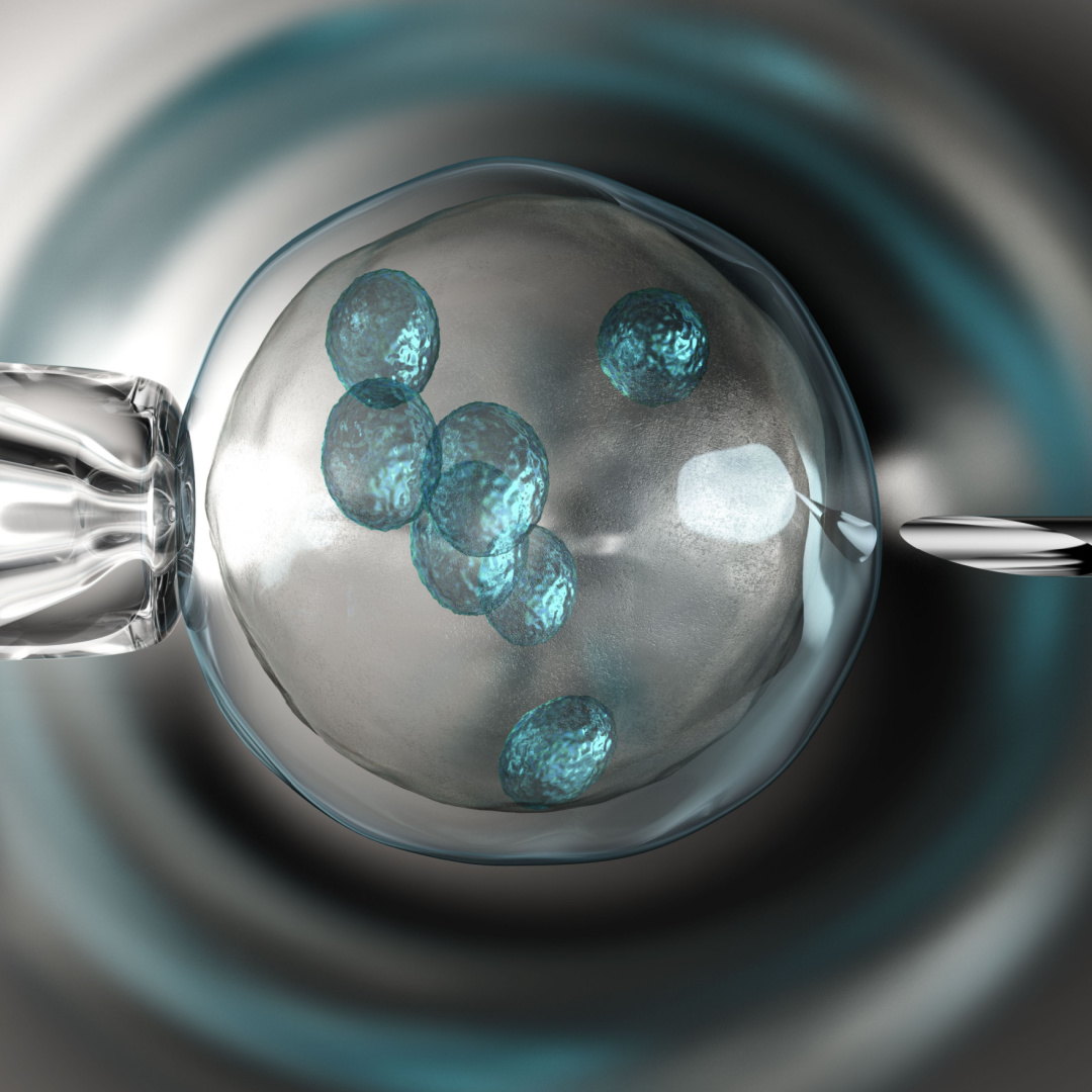 Preguntas frecuentes sobre la Fecundación in vitro