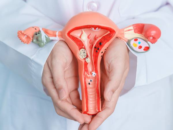 Síntomas y diagnóstico de la endometriosis